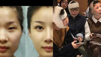 Chinese Tourists Face Issues Returning To China After Plastic Surgery In South Korea; Need Doctor Certs To Prove Identities