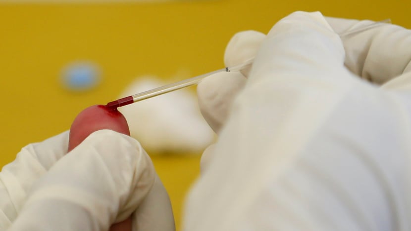 HIV data leak incident could recur unless multiple layers of checks are in place, say experts