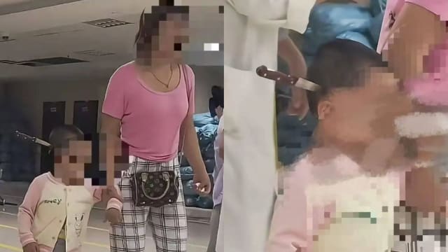水果刀插入头 中国三岁女童开颅取刀保一命