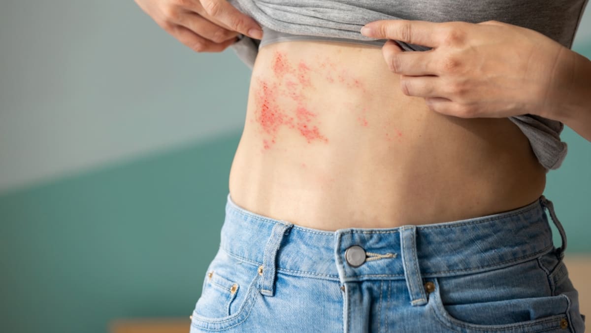 Why shingles hits harder with diabetes
