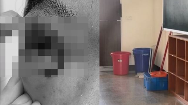 不满被叫回座位 台中小六生挥扫把打老師脸部溅血恐失明