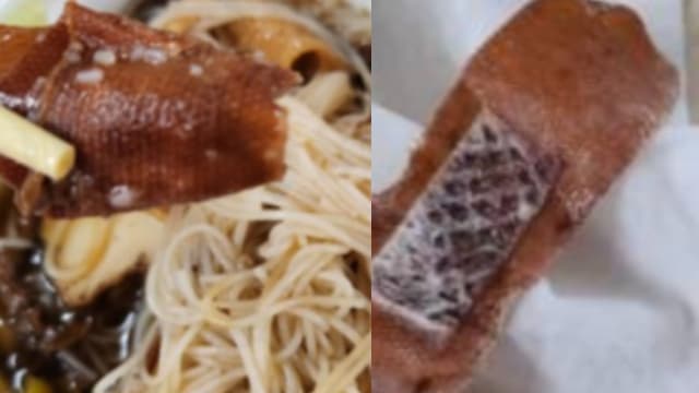 食客用餐时咬下沾满血迹胶布 网民直呼恶心