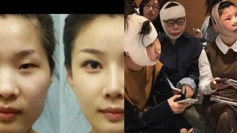 Chinese Tourists Face Issues Returning To China After Plastic Surgery In South Korea; Need Doctor Certs To Prove Identities Chinese Tourists Face Issues Returning To China After Plastic Surgery In South Korea; Need Doctor Certs To Prove Identities