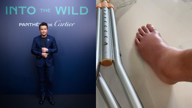 李铭顺左脚“肿成猪腿”　将缺席金钟奖颁奖典礼
