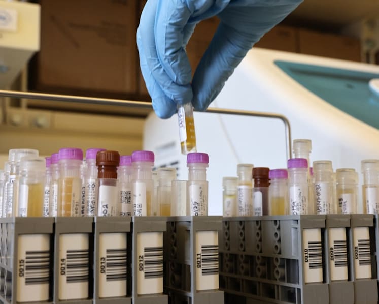 FAQ: What you need to know about Novavax's non-mRNA COVID-19 vaccine Nuvaxovid