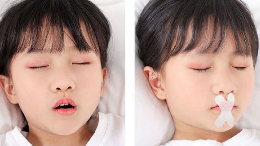 Singapore authorities to look into sale of mouth breathing tapes, head shaping helmets for children Singapore authorities to look into sale of mouth breathing tapes, head shaping helmets for children