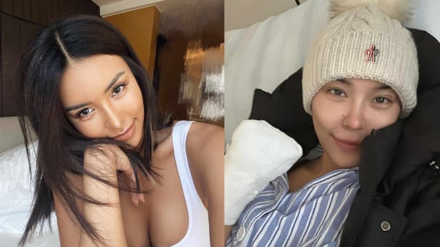 中国女模遇意外事故　导致左手截肢