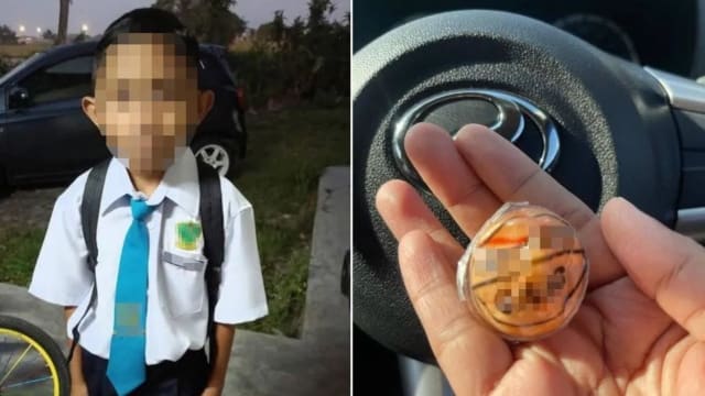 疑吞食“眼球软糖”噎住 马国男童缺氧送院抢救