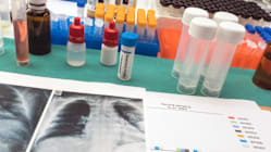 Related article image