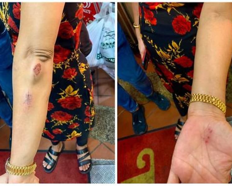 Police investigating case of a man who allegedly used racial slurs, kicked woman for not wearing mask