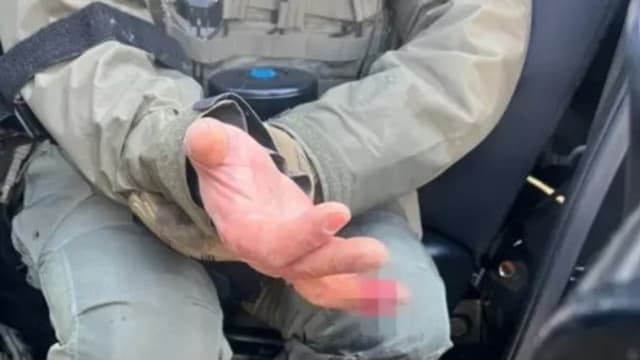 对街头抗议执法  美联邦执法局特工遭抗议者咬断手指致永久伤残