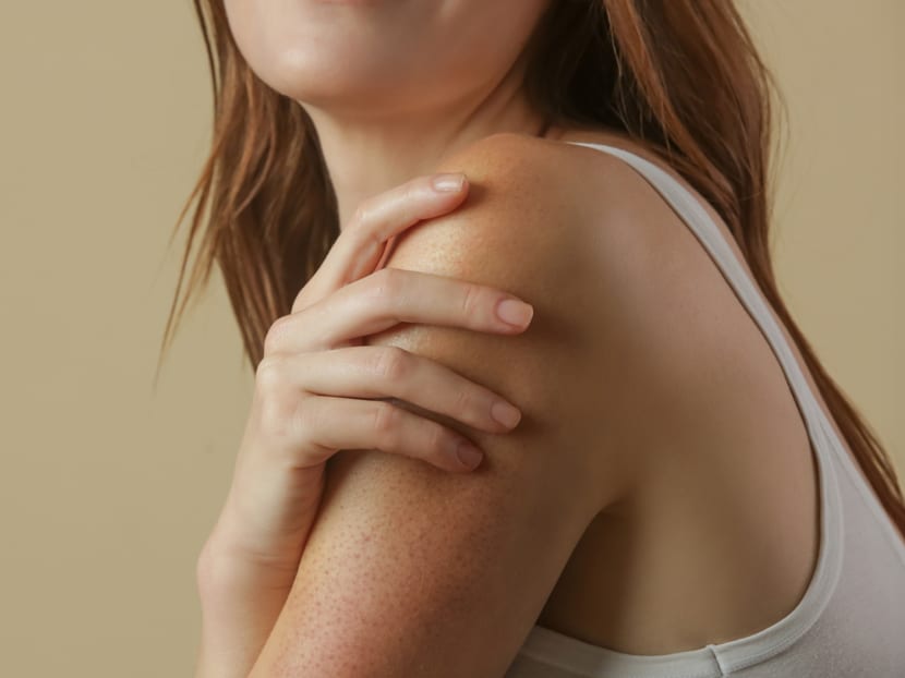 Got rough, bumpy patches on your arms and thighs? Here’s how to deal with 'chicken skin'
