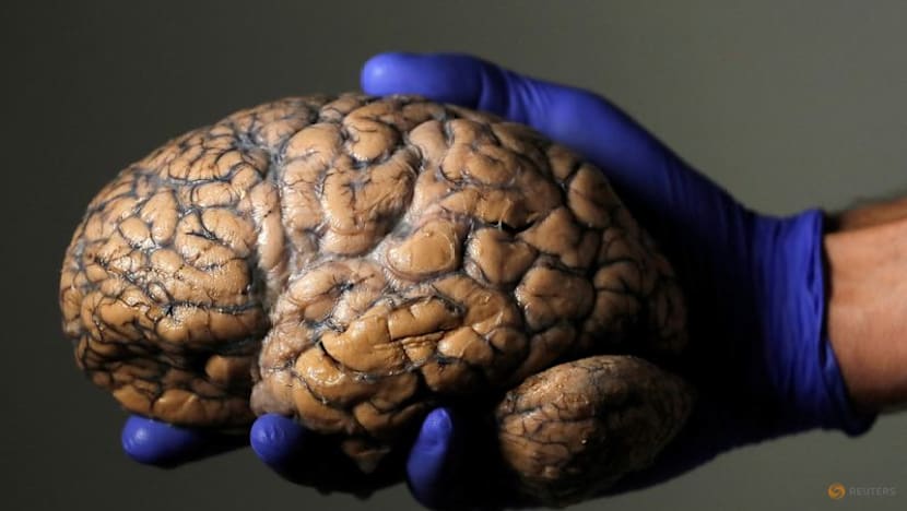 Scientists unveil first draft of atlas of the developing brain
