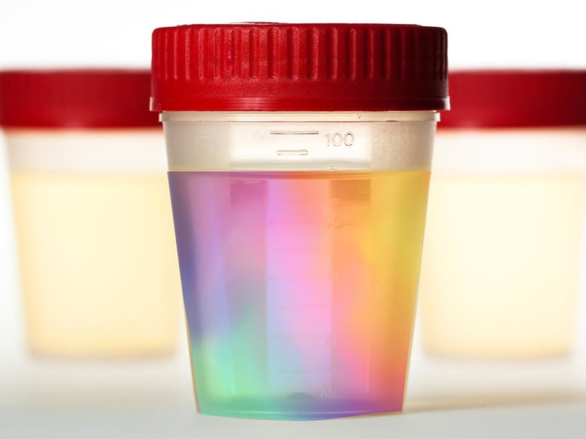 What does the colour of your pee say about your health?