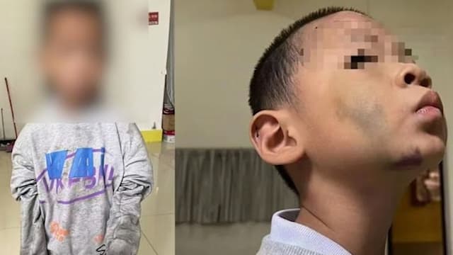 中国姐弟遭继母虐待 男童遭烫伤下体逼吃大便