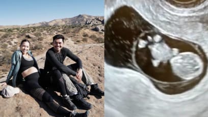 Henry Golding’s Wife Liv Lo Reveals She Suffered A Miscarriage Earlier This Year