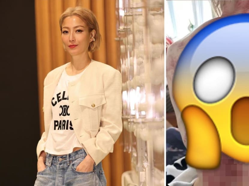 Sammi Cheng Posted A Pic Of Her Post-Gua Sha Back & It Looks Like A Rack Of Meat