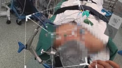 Related article image