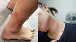 Related article image