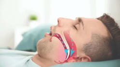 Related article image