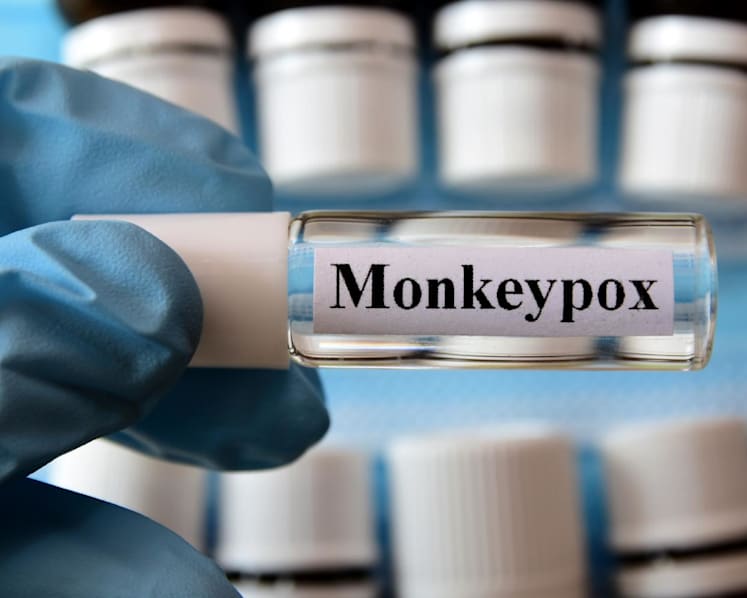 Singapore reports 10th case of monkeypox infection 