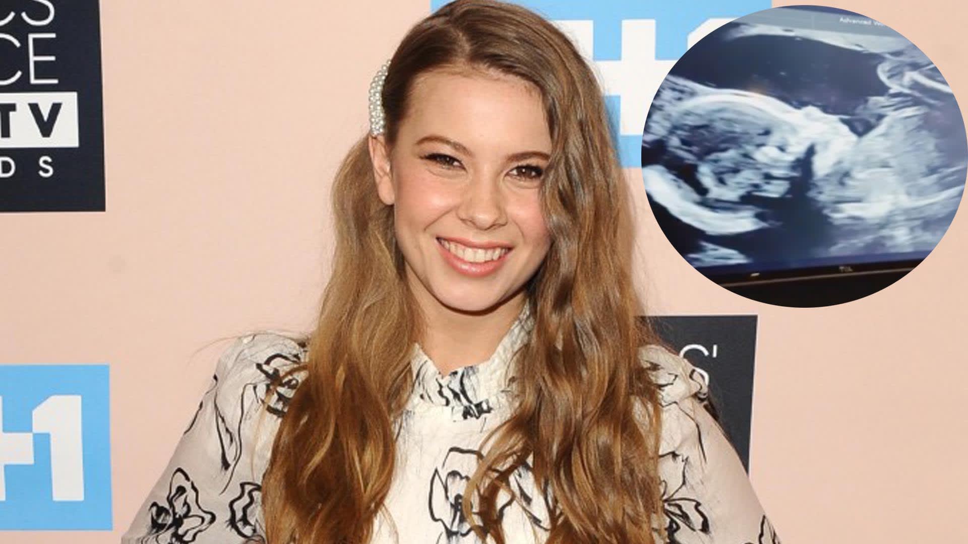 Bindi Irwin Shares Ultrasound Video of Baby Girl "She's So Beautiful
