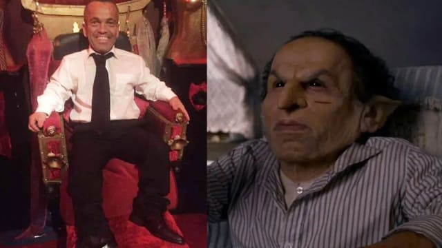曾出演“Harry Potter”和“Star Wars”　侏儒症演员脑死拔管