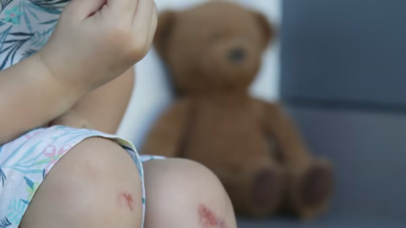 Ibu buat laporan polis, lebam pada anak perempuan 3 tahun disangka dari prasekolah tetapi amah pelakunya