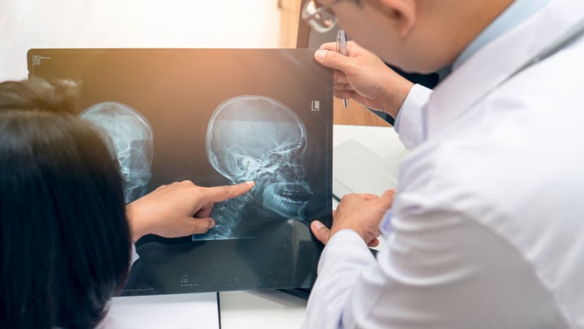 Getting ahead of head and neck cancers Getting ahead of head and neck cancers