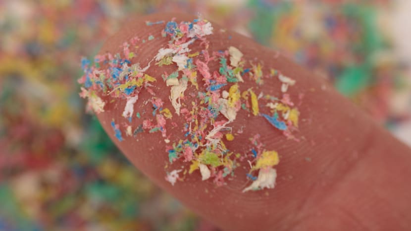 மூளையில் பிளாஸ்டிக் நுண்துகள்கள் உள்ளனவா?