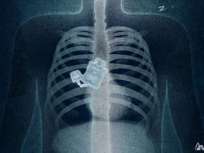 What to do when you've swallowed something you shouldn't have