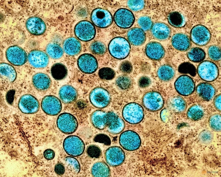 CNA Explains: Deadlier and more contagious – how dangerous is the new mpox variant?