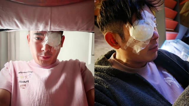 黄俊雄视网膜脱落紧急手术　自嘲变“躺平族”：要胖5kg到10kg