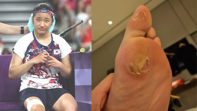安洗莹被强制穿赞助球鞋脚起水泡  韩国羽总承诺改革