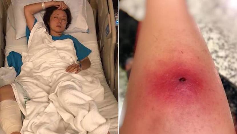 How Did A Small Bug Bite Cause Quan Yifeng To Get Hospitalised And Undergo Two Surgeries? How Did A Small Bug Bite Cause Quan Yifeng To Get Hospitalised And Undergo Two Surgeries?