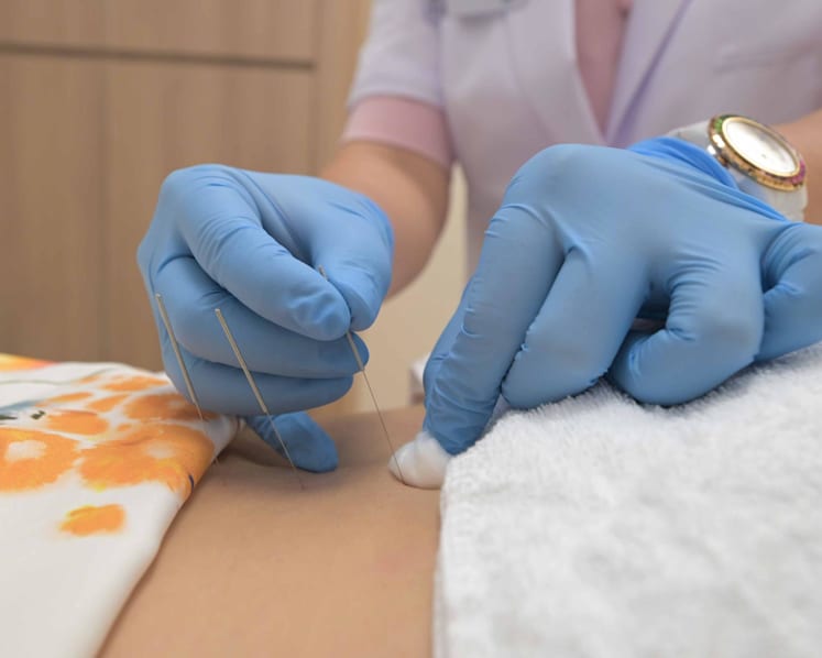From painkillers to acupuncture: Singapore's public hospitals expand TCM use in acute care