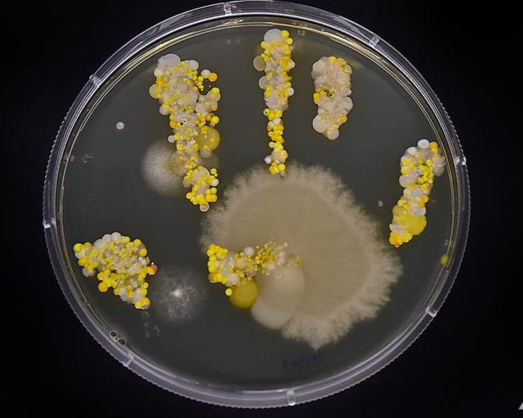 In pictures: The bacteria living on your hands right now