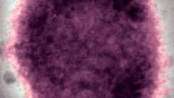 Related article image
