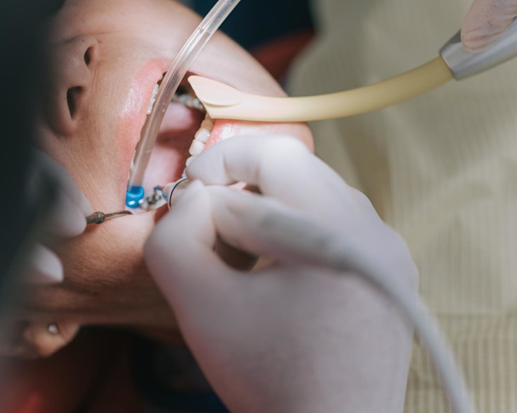 Why are root canal treatments so expensive, and what options do you have if you need one?