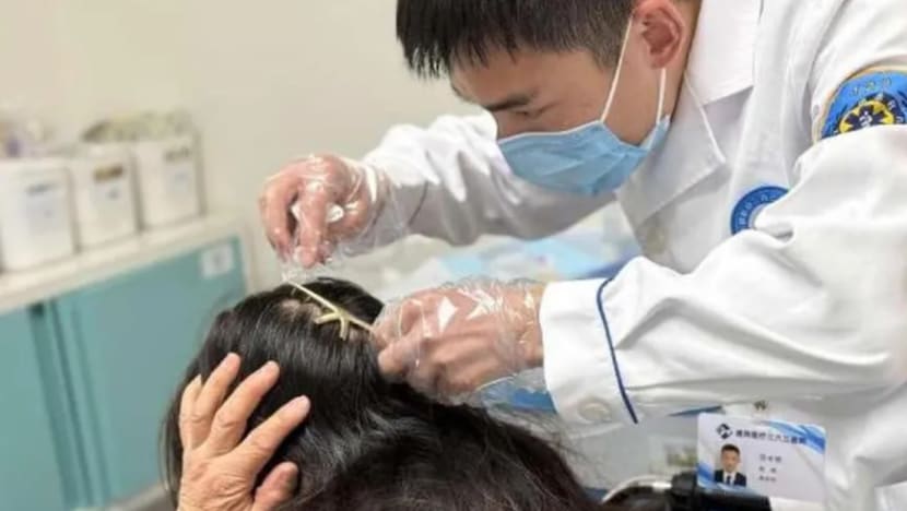 Metal hair claw pierces woman's head after traffic accident in China Metal hair claw pierces woman's head after traffic accident in China