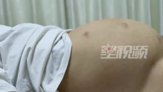 中国女大生“肚子大” 搓澡阿姨一句话救了她