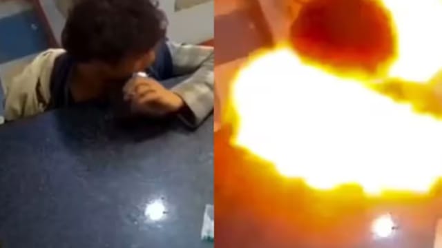 印度男孩咬锂电池 引发爆炸受伤