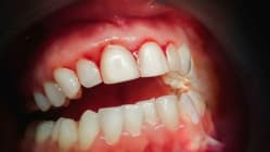 Related article image