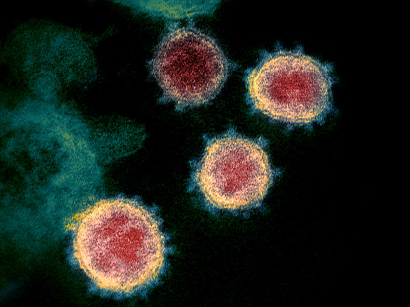 A transmission electron microscope image shows SARS-CoV-2, also known as novel coronavirus.