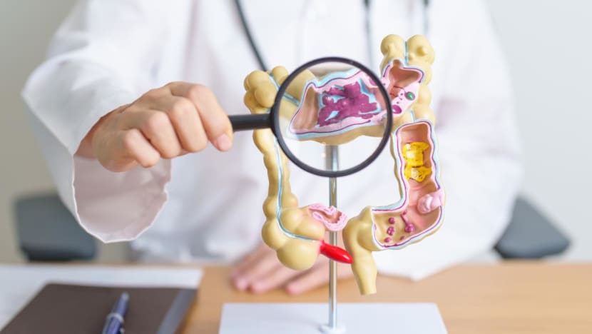 Kanker usus besar melonjak di Indonesia, apa penyebabnya?