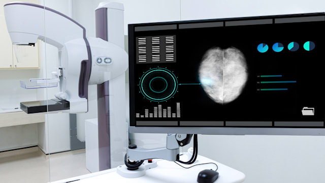 国大癌症中心研究：发送提醒邮件 接受乳房检查妇女增加三倍