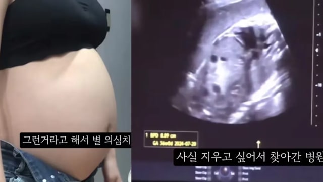 36周堕胎胎儿放冷冻库 韩检方控谋杀