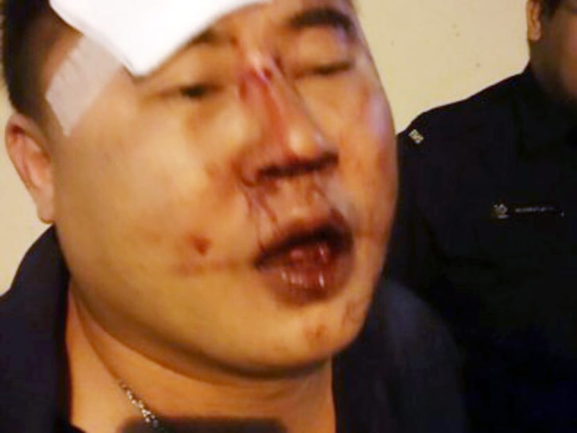 This picture allegedly shows businessman Lim Chin Huat who claims to have suffered injuries when he was restrained by police officers . The police are investigating a report alleging that police officers have abused a 41-year-old male Singaporean during a spot check last week.