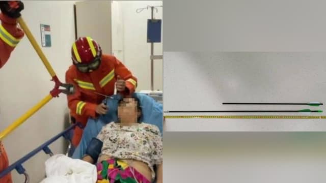 祸从天降！中国老妇小区散步遭弓箭射穿面部