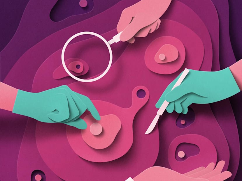 To treat prostate cancer, there are more options than ever